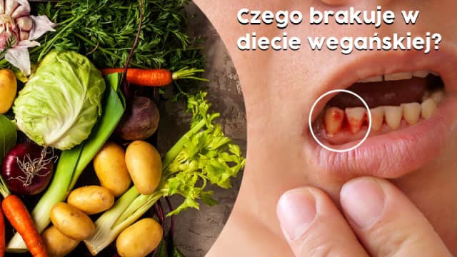 Czego brakuje w diecie wegańskiej i jak uniknąć niedoborów? Czego brakuje w diecie wegańskiej i jak uniknąć niedoborów?